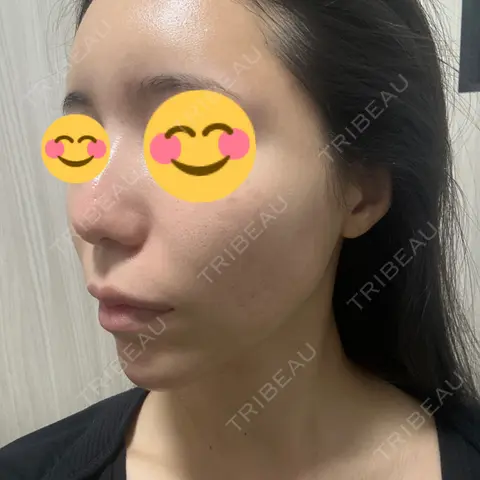 ポテンツァ LUNA BEAUTY CLINIC 池袋駅前院 AFTER