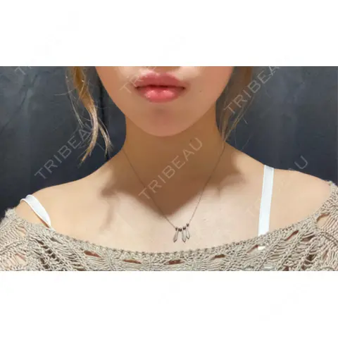 ボトックス（肩） DMTC美容皮膚科 日本橋院 DAY 0