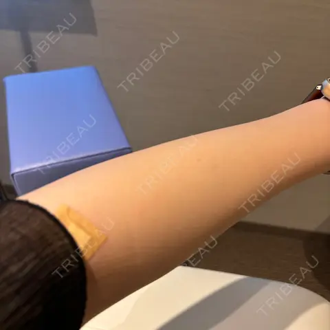 美容点滴・美容注射（美肌） MYCLINIC 西新宿 AFTER