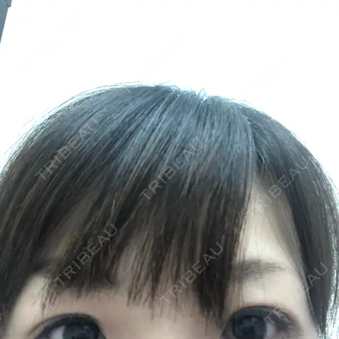 二重埋没 TCB東京中央美容外科 川口院 DAY 0