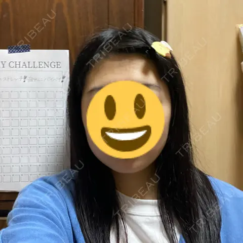 ボトックス（エラ・小顔） 湘南美容クリニック 本厚木院 AFTER