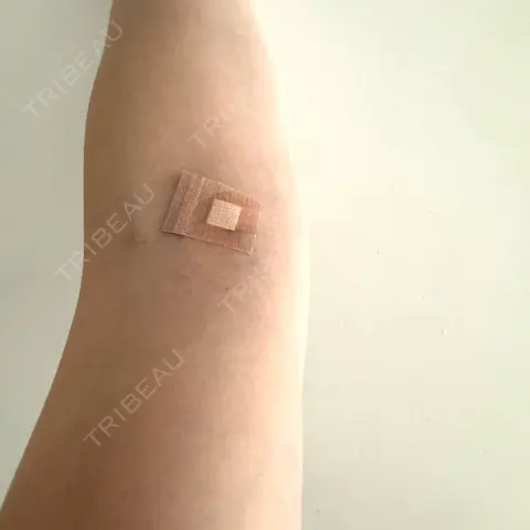 白玉点滴・注射 / 美容点滴・美容注射（疲労回復） 新宿美容内科医療クリニック AFTER