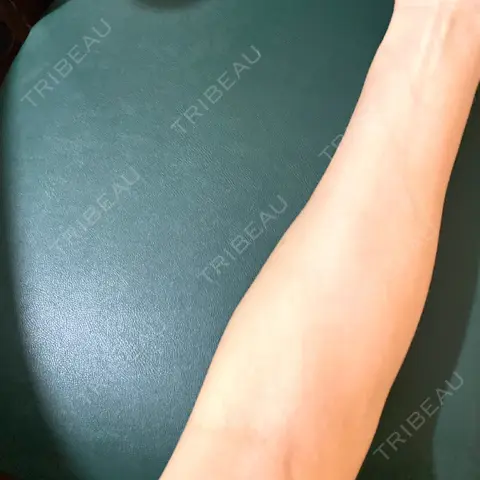 白玉点滴・注射 新宿美容内科医療クリニック AFTER