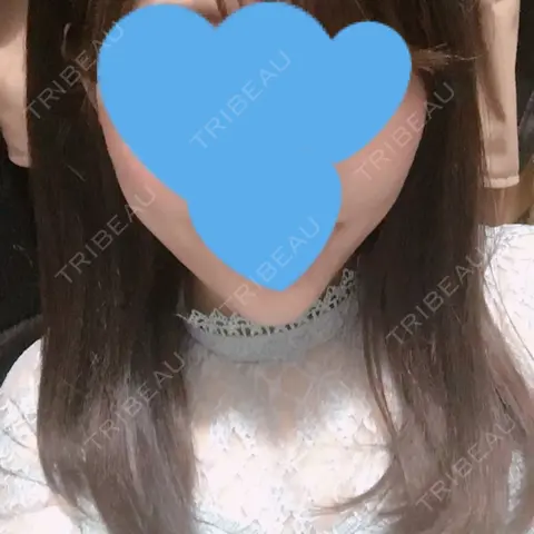 糸リフト / ヒアルロン酸注入（あご） / ボトックス（エラ・小顔） / 脂肪溶解注射（顔） TCB東京中央美容外科 郡山院 AFTER