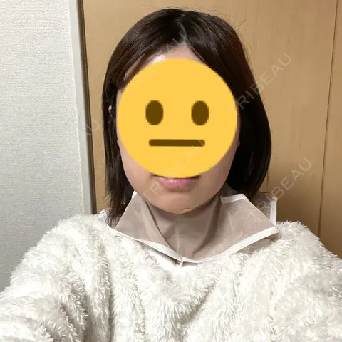 糸リフト / バッカルファット除去 / 脂肪吸引（顔） / ボトックス（エラ・小顔） アリエル美容クリニック 大宮院 DAY 1