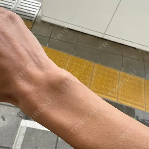 医療脱毛（全身） ジュエルクリニック 恵比寿院 AFTER
