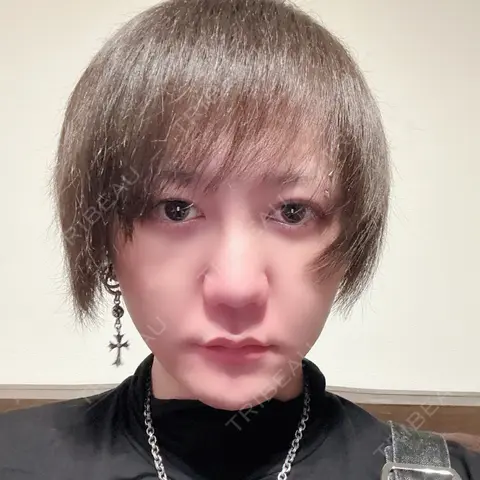 二重切開 / 目頭切開 / 眼瞼下垂（切開） / 隆鼻術 / 鼻中隔延長（切開） / 小鼻縮小（切開） / 骨切幅寄せ id（アイディ）美容外科 AFTER