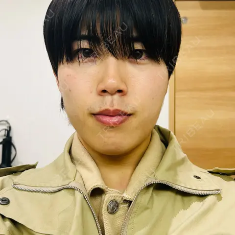 脂肪吸引注射（顔） ziz CLINIC AFTER