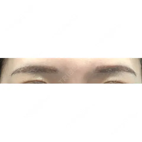アートメイク（眉） LEAGRANT CLINIC 中目黒 AFTER