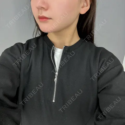 脂肪吸引（顔） / 脂肪吸引注射（顔） ziz CLINIC AFTER