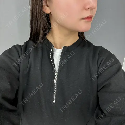 脂肪吸引（顔） / 脂肪吸引注射（顔） ziz CLINIC AFTER