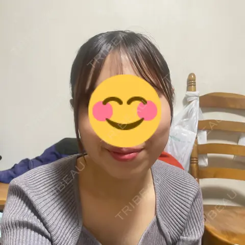 糸リフト / 脂肪吸引（顔） THE FIRST CLINIC 多摩センター院 AFTER
