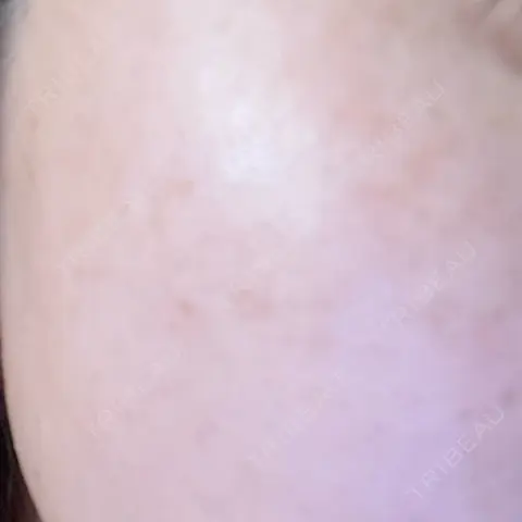 白玉点滴・注射 LE CLINIC AFTER