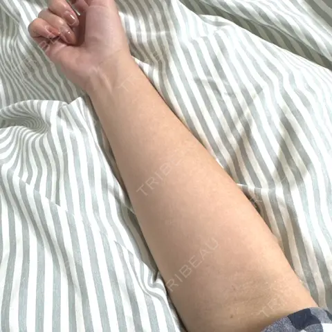 白玉点滴・注射 / 高濃度ビタミンC点滴 Kinshicho Beauty Clinic （錦糸町ビューティークリニック） DAY 1