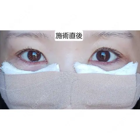 クマ治療 WOM CLINIC GINZA （ワム クリニック ギンザ） DAY 0