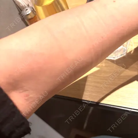 白玉点滴・注射 ちぐさ内科クリニック 覚王山 DAY 0
