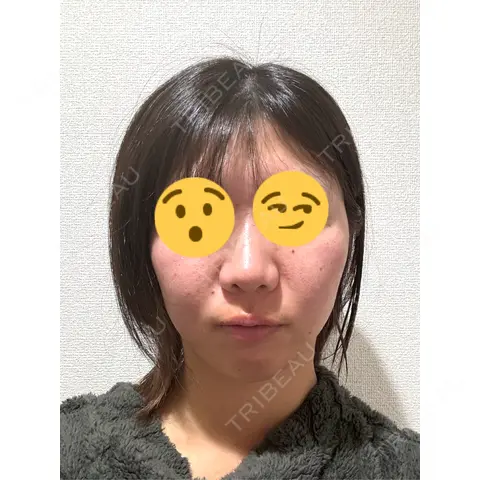 ポテンツァ NARU Beauty Clinic 【ナルクリ】 DAY 0