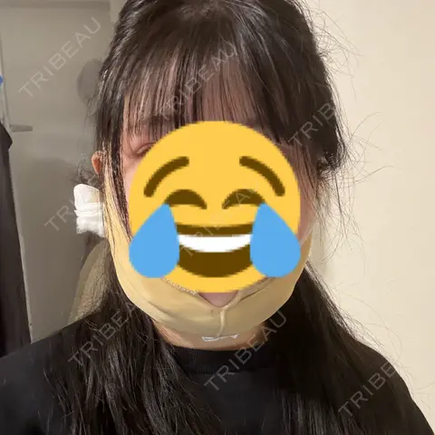 糸リフト / 脂肪吸引（顔） / 脂肪吸引（二の腕） / ヒアルロン酸注入（あご） / ボトックス（エラ・小顔） ヴェルトラクリニック 大阪院 DAY 0