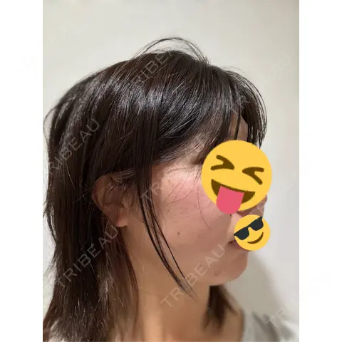 ポテンツァ NARU Beauty Clinic 【ナルクリ】 AFTER