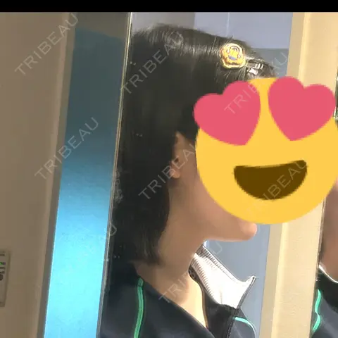 その他（輪郭） ルラ美容クリニック 町田院 AFTER