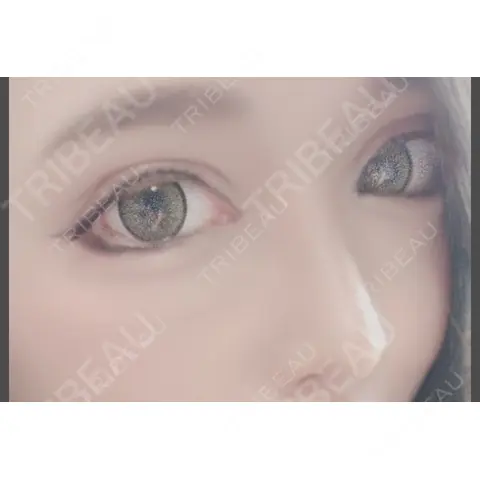 二重切開 / 目頭切開 / 眼瞼下垂（切開） / 隆鼻術 / 目尻切開 / 上まぶたたるみ取り / 軟骨移植 湘南美容クリニック 岡山院 AFTER