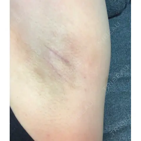 その他 しんはま耳鼻科・美容外科・形成外科・しんはま皮ふ科 AFTER