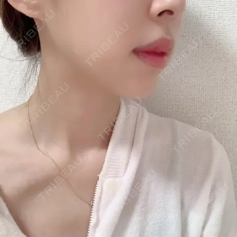 ハイフ（顔） TCB東京中央美容外科 中野院 AFTER