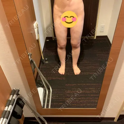 脂肪溶解注射（太もも） / 脂肪溶解注射（お尻） 水の森美容クリニック 名古屋院 DAY 1