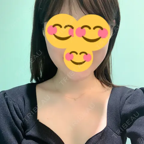 脂肪吸引（顔） / メーラーファット除去 / ボトックス（エラ・小顔） WOM CLINIC GINZA （ワム クリニック ギンザ） AFTER