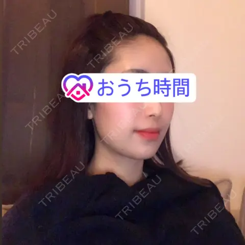 ボトックス（エラ・小顔） / ハイフ（顔） 湘南美容クリニック 渋谷アネックス院 AFTER