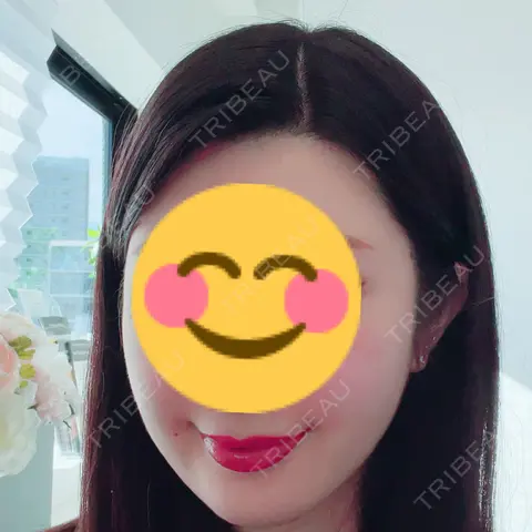 アートメイク（唇） LEAGRANT CLINIC 中目黒 DAY 0