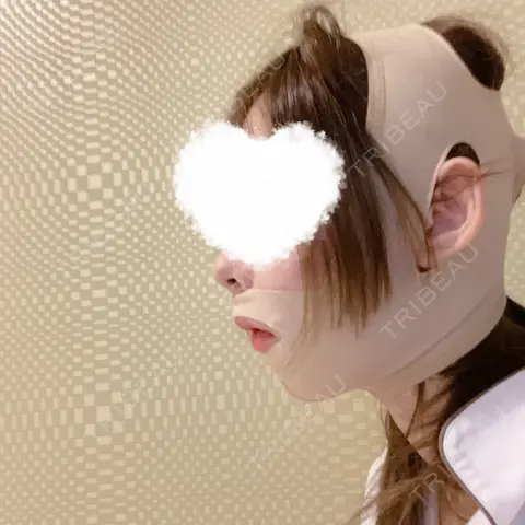 骨切り（あご） / セットバック アーククリニック DAY 0