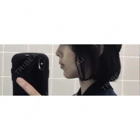 ボトックス（あご） / ヒアルロン酸注入（あご） 銀座みゆき通り美容外科 大阪梅田院 DAY 0