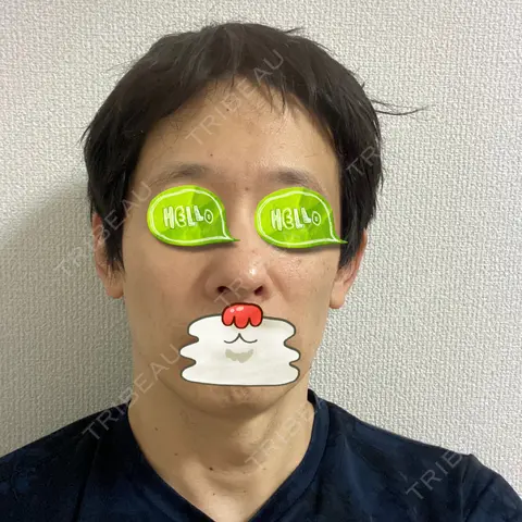 ルメッカ TIAM CLINIC GINZA AFTER