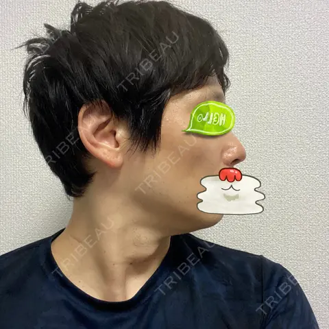 ルメッカ TIAM CLINIC GINZA AFTER