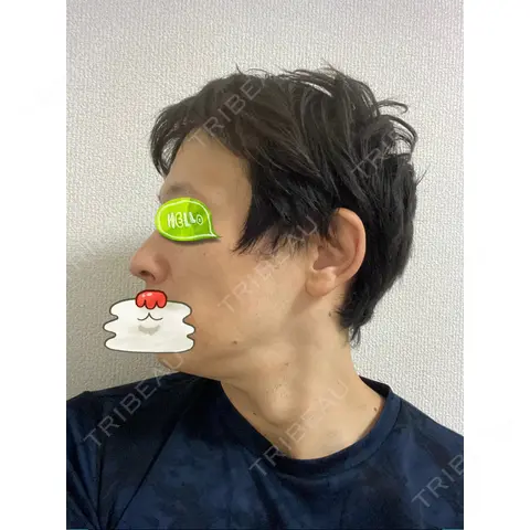 ルメッカ TIAM CLINIC GINZA AFTER
