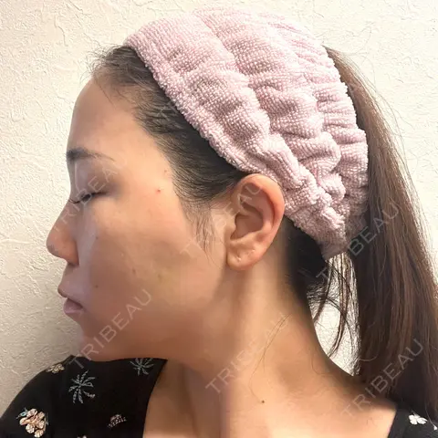 クマ治療 / 額を丸く / 下まぶたたるみ取り / 脂肪注入（額） / 脂肪注入（輪郭） 湘南美容クリニック 品川院 AFTER