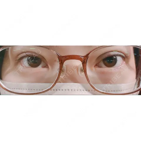 二重埋没 AILE Clinic DAY 0