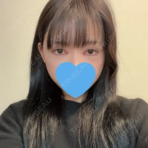 目頭切開 / クマ治療 / タレ目形成・グラマラスライン（切開） HAAB×DREAM BEAUTY CLINIC 大阪梅田院 DAY 0