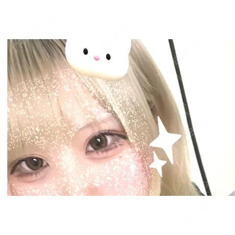 ヒアルロン酸注入（目の下） 宇都宮ひふ科形成外科 AFTER