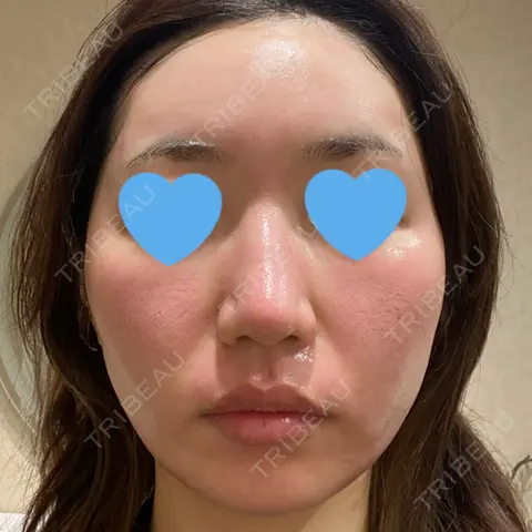 ポテンツァ LOUIS CLINIC 二子玉川院【ルイクリニック】 DAY 0