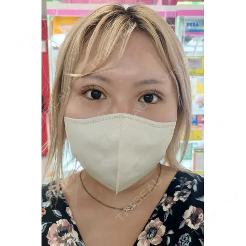 二重埋没 / 上まぶたの脂肪取り / ヒアルロン酸溶解 AI Beauty Clinic （エーアイ美容クリニック） DAY 0