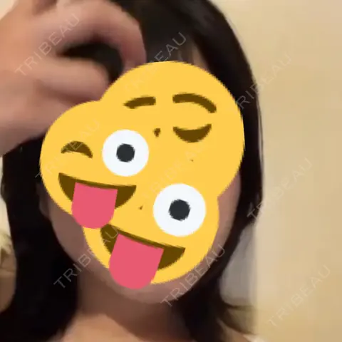 脂肪吸引（顔） ルラ美容クリニック 大阪本院 AFTER