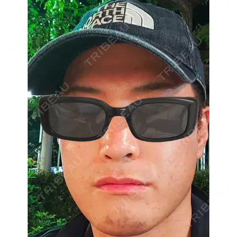 シミ取りレーザー Olino美容外科・美容皮膚科 AFTER