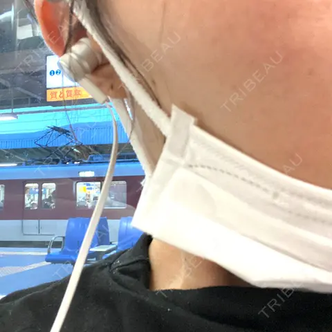 シミ取りレーザー Olino美容外科・美容皮膚科 AFTER