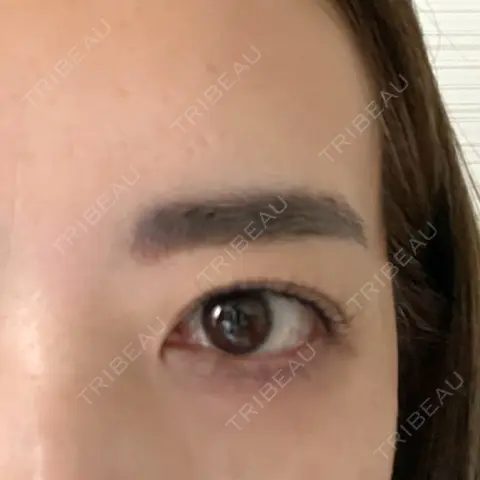 アートメイク（アイライン） 筋肉・美容クリニック AFTER