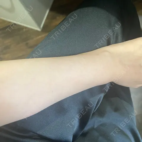 白玉点滴・注射 椿クリニック 心斎橋院 AFTER