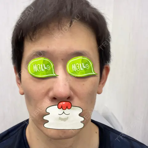 ルメッカ TIAM CLINIC GINZA AFTER