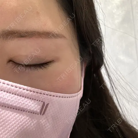 アートメイク（アイライン） Tokyo Tensei Clinic 銀座院 AFTER