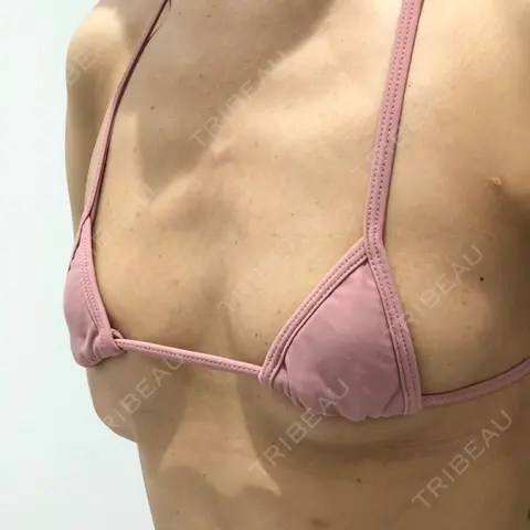 豊胸（脂肪注入） BELINDA CLINIC（ベリンダクリニック）新宿院 AFTER